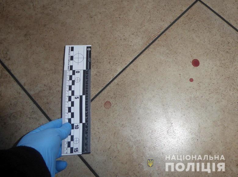 У Києві за розбійний напад затримано трьох молодиків - dnrozbiy1610193 prygody, novyny, kryminal, kyyivshhyna У Києві за розбійний напад затримано трьох молодиків - - dnrozbiy1610193